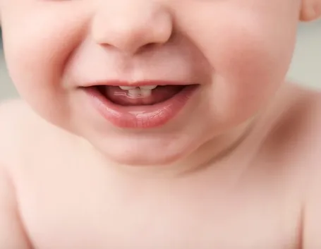 dentini da latte