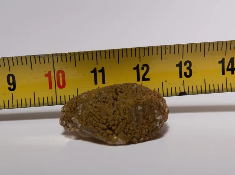 Misura calcolo