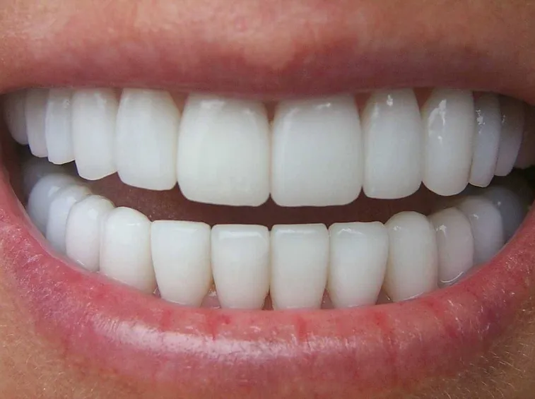 denti