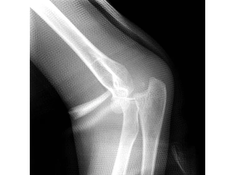 radiografia