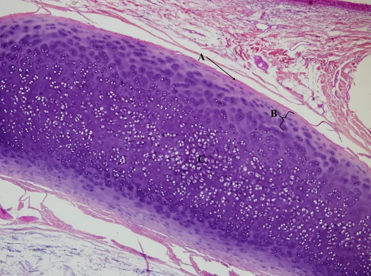 cartilagine