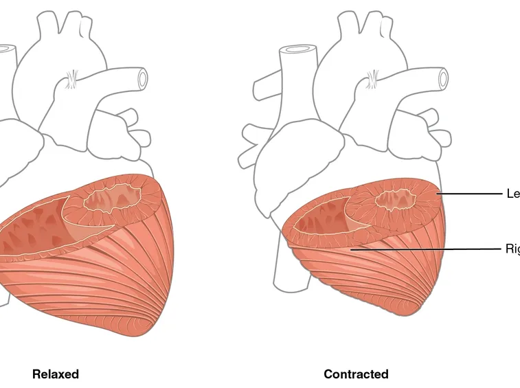 Spessore del miocardio dei ventricoli