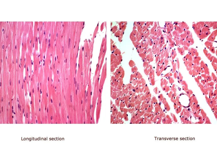 Cellule muscolari del miocardio