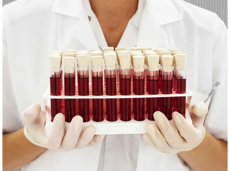 Provette per esami del sangue